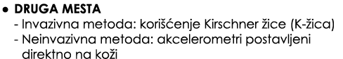 • Druga mesta Invazivna metoda: kori enje Kirschner  ice (K  ica) Neinvazivna metoda: akcelerometri postavljeni dire...
